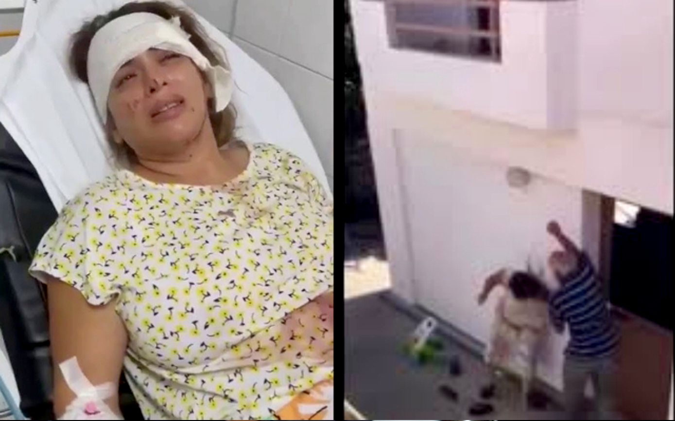 ضرب و شتم زن پناهجوی ایرانی به‌دست صاحب‌خانه‌اش در قبرس